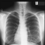 4x6 X Ray Photos Print Them Laminate Them And Use Them